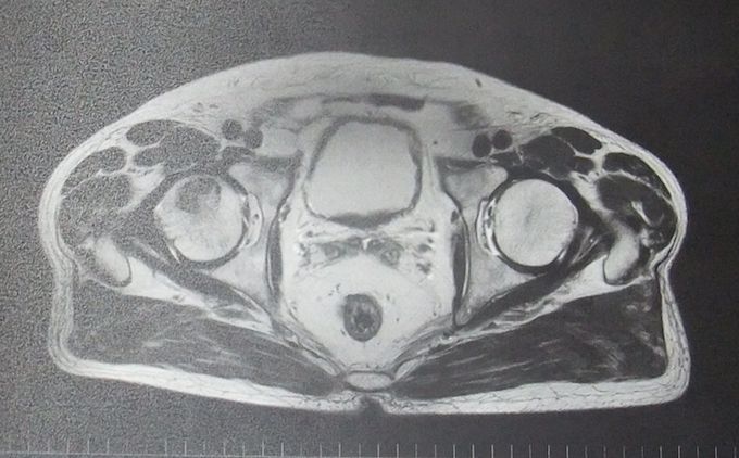 MRI-1.jpg